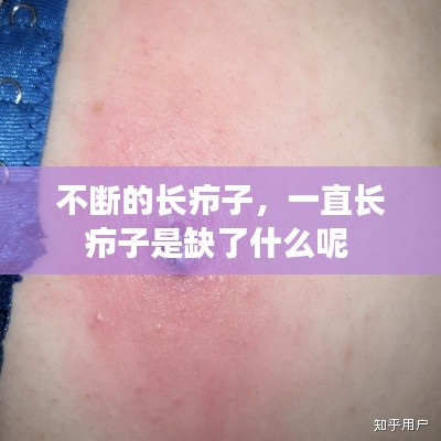 不断的长疖子,一直长疖子是缺了什么呢